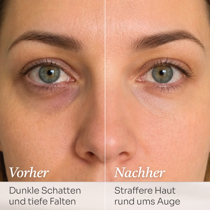 Superlift Anti-Aging Eye Cream