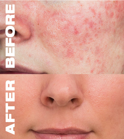SENSITIVE SKIN CODE+ EYE CREAM