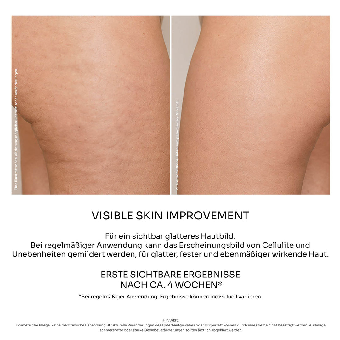 Superlift Anti-Cellulite Therapy