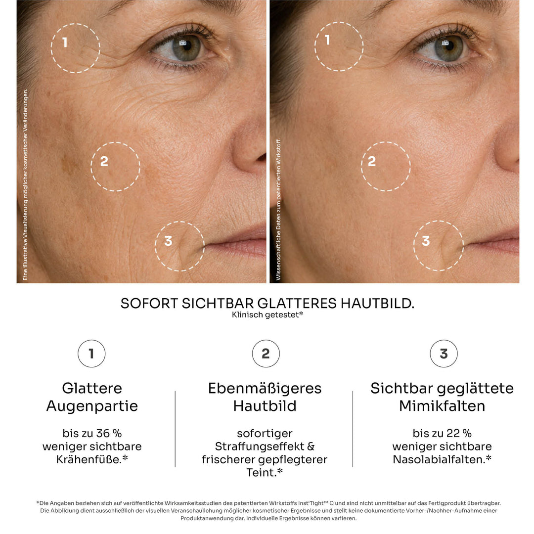 Superlift Anti-Aging Set